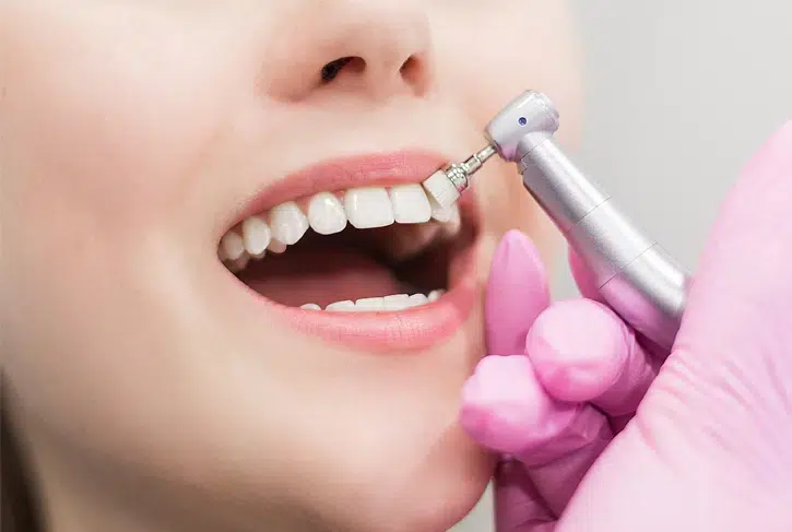 Dental Hygiene in Pocatello, ID - Modern Smiles