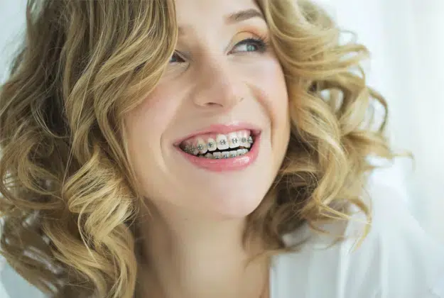 Traditional Braces in Pocatello, ID - Modern Smiles