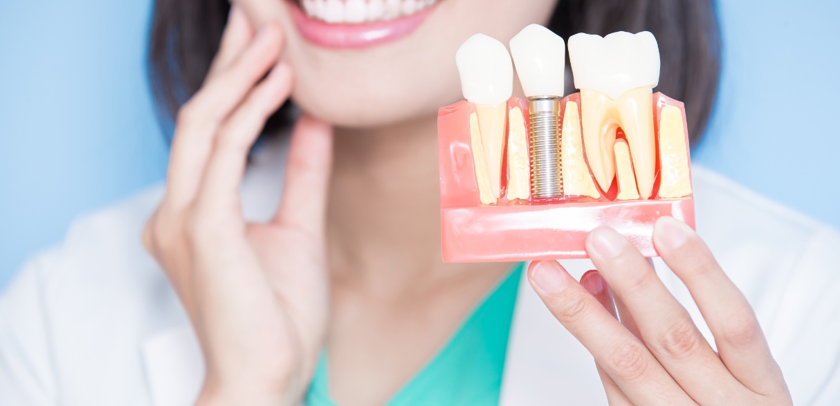 how dental implants can significantly leave your face