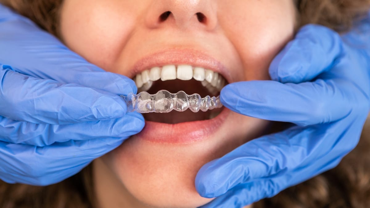 Invisalign in Pocatello